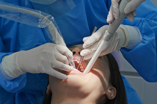 Do I Need Scaling And Root Planing?