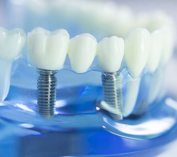 Chesapeake Dental Implants
