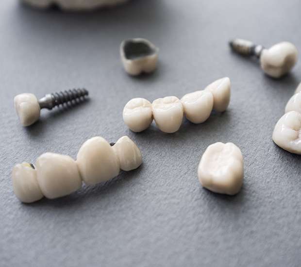 Chesapeake The Difference Between Dental Implants and Mini Dental Implants